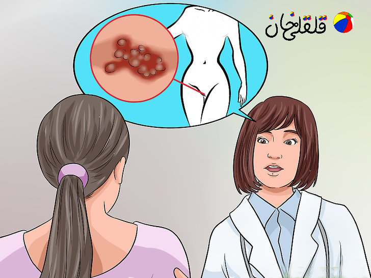 درمان سریع تبخال تناسلی مردان و زنان، قرص تبخال تناسلی ۱ - قلقلی خان درمان سریع تبخال تناسلی مردان و زنان، قرص تبخال تناسلی ۱ - قلقلی خان