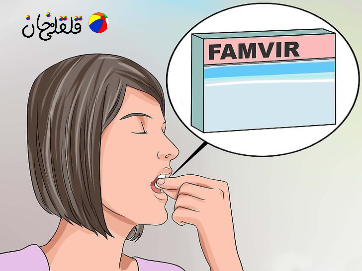 درمان سریع تبخال تناسلی مردان و زنان، قرص تبخال تناسلی ۴ - قلقلی خان درمان سریع تبخال تناسلی مردان و زنان، قرص تبخال تناسلی ۴ - قلقلی خان