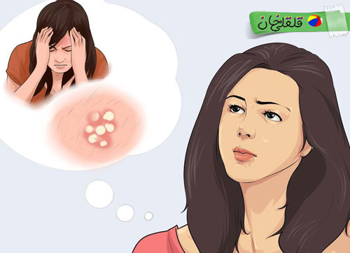 زندگی کردن با ویروس تبخال تناسلی - هرپس تناسلی ۶ - قلقلی خان زندگی کردن با ویروس تبخال تناسلی - هرپس تناسلی ۶ - قلقلی خان