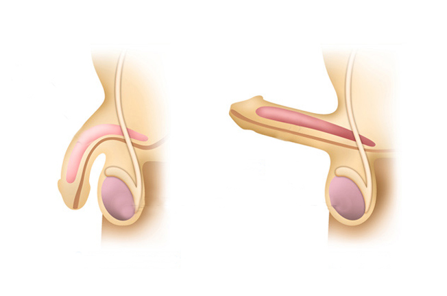نعوظ چیست ، نعوظ چگونه رخ می دهد ، نعوظ کامل چگونه است ، شق شدن آلت - قلقلی خان