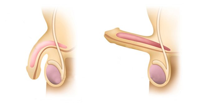نعوظ چیست ، نعوظ چگونه رخ می دهد ، نعوظ کامل چگونه است - قلقلی خان